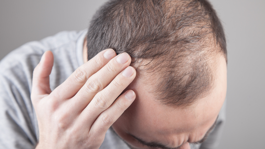 Stinging Nettle for Hair Loss: Does It Work?